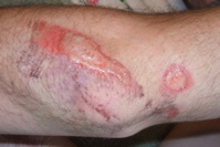 I think I did most of my slide on my left elbow...